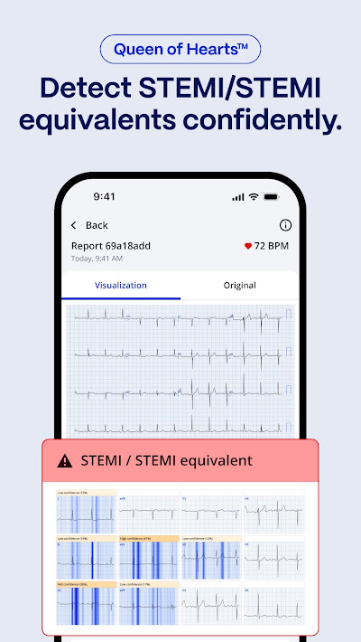 PMcardio for Individuals app screenshot 3